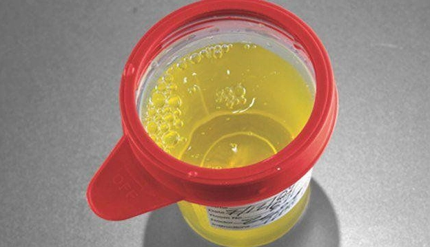 Cấu tạo thận và cầu thận